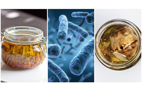 Botulismo alimentare: 
strategie di prevenzione e controllo nella filiera alimentare, alla luce degli 
orientamenti nazionali a seguito dei recenti focolai italiani